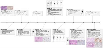 Heterogeneous SSTR2 target expression and a novel KIAA1549::BRAF fusion clone in a progressive metastatic lesion following 177Lutetium-DOTATATE molecular radiotherapy in neuroblastoma: a case report